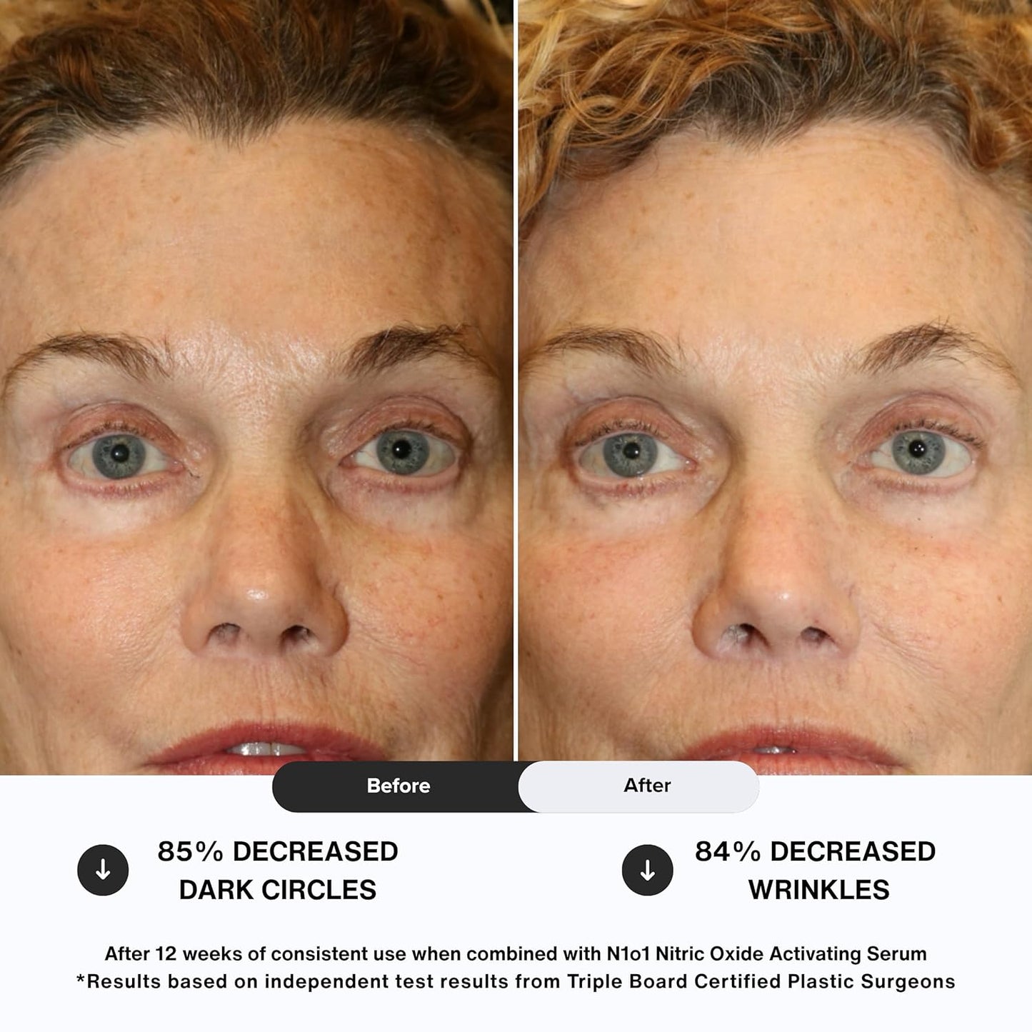 Age-Defiance Eye Cream - Day & Night Moisturizer with Nitric Oxide, Hyaluronic Acid, Complex Peptides, Ceramides - Hydrating Eye Cream for Dark Circles, Wrinkles, Fine Lines, Puffiness - 0.5 oz.