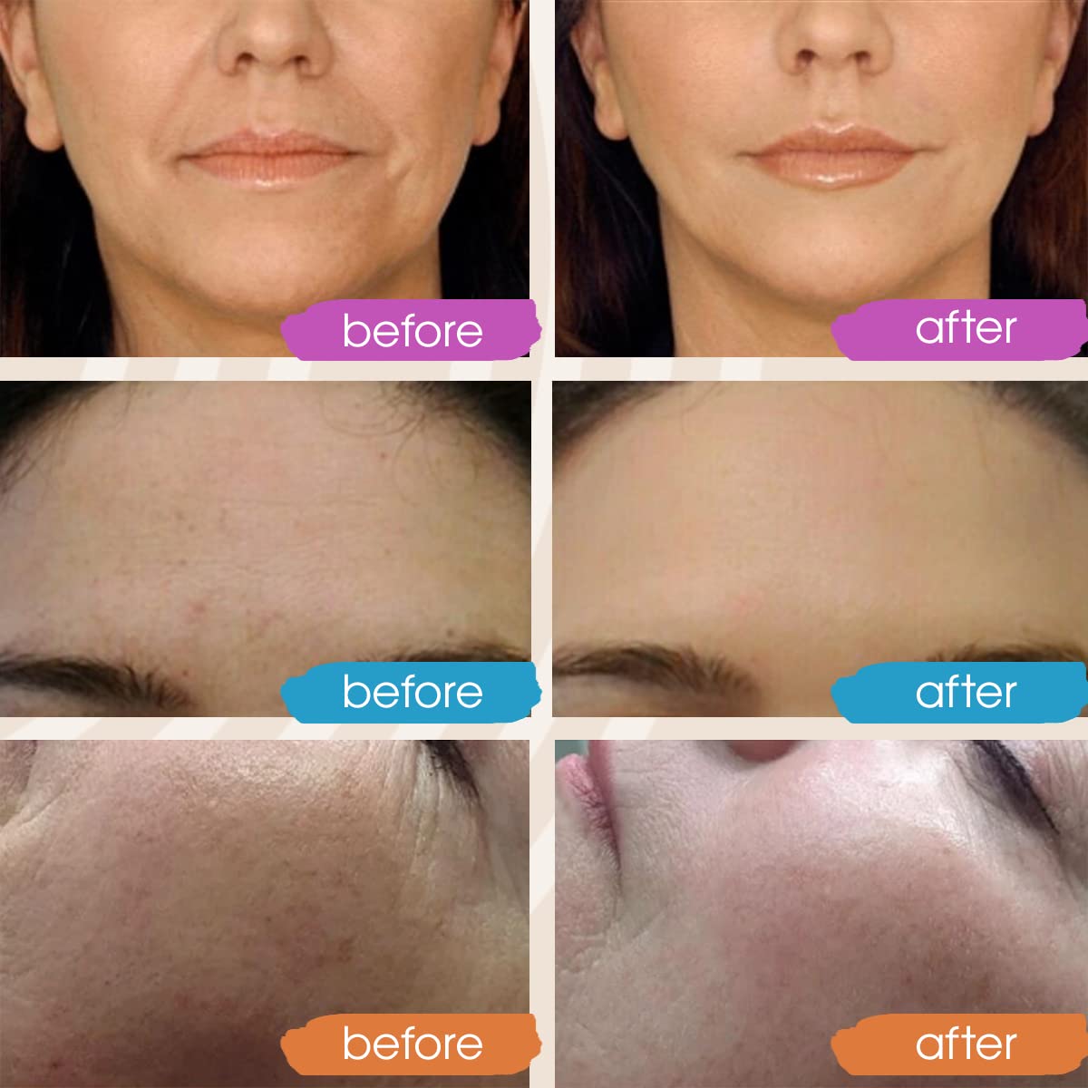 Retinol Serum for Face, Vitamin C with Hyaluronic Acid Face Serum for Women and Men, Glow Total Package Skin Care Set, Targets Appearance of Uneven Skin Tone and Dryness 3x2 oz