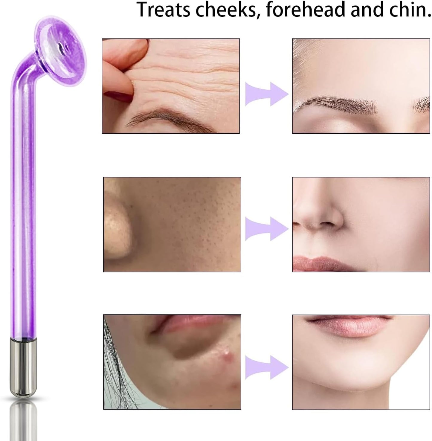 Spare Parts Mushroom for Handheld HIF Facial Hair Device Facial Care Orange Purple Blue Color Glass Tube Electrode Elitzia ETJX0066 (Purple)