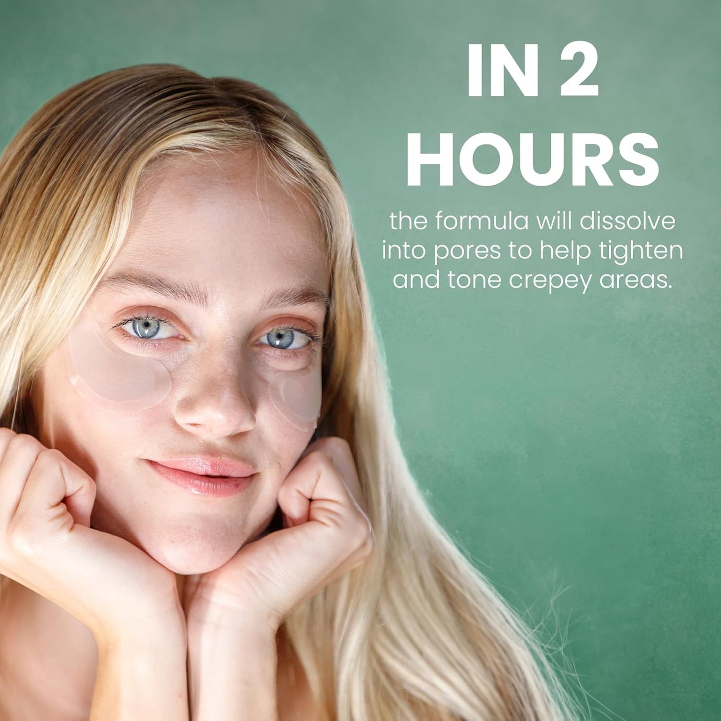 skyn ICELAND Dissolving Microneedle Under Eye Patches with 39% Hyaluronic Acid and Peptides, No Slip Overnight Eye Mask for Fine Lines, Wrinkles and Firming, Vegan, All Skin Types, 3 Pairs