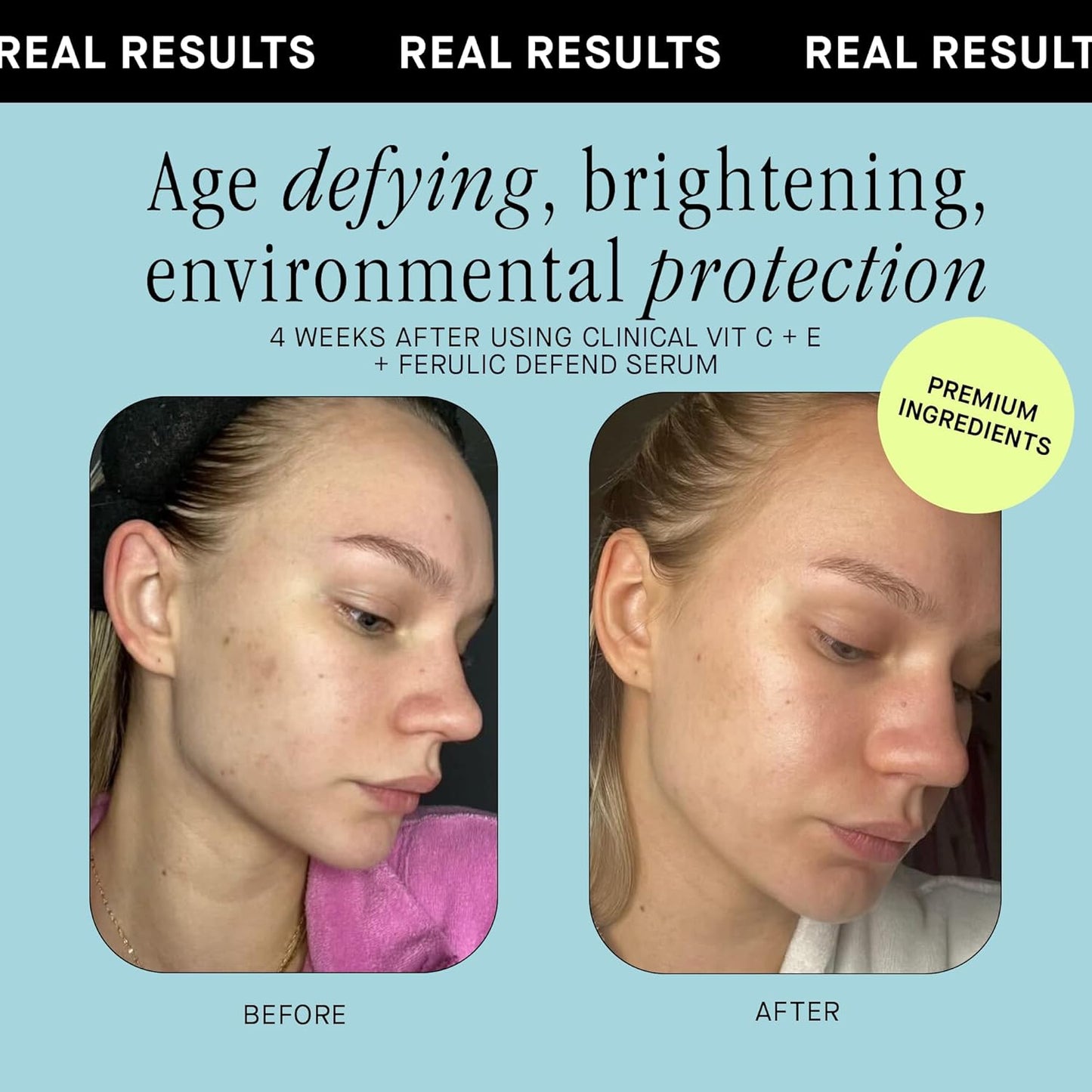 Brandefy Vitamin C Face Serum 15% L. Ascorbic Acid, Ferulic Acid .5% + Vitamin E for Self Care and Beauty, Face Dark Spot Corrector and Anti Aging 1oz, Made In The USA