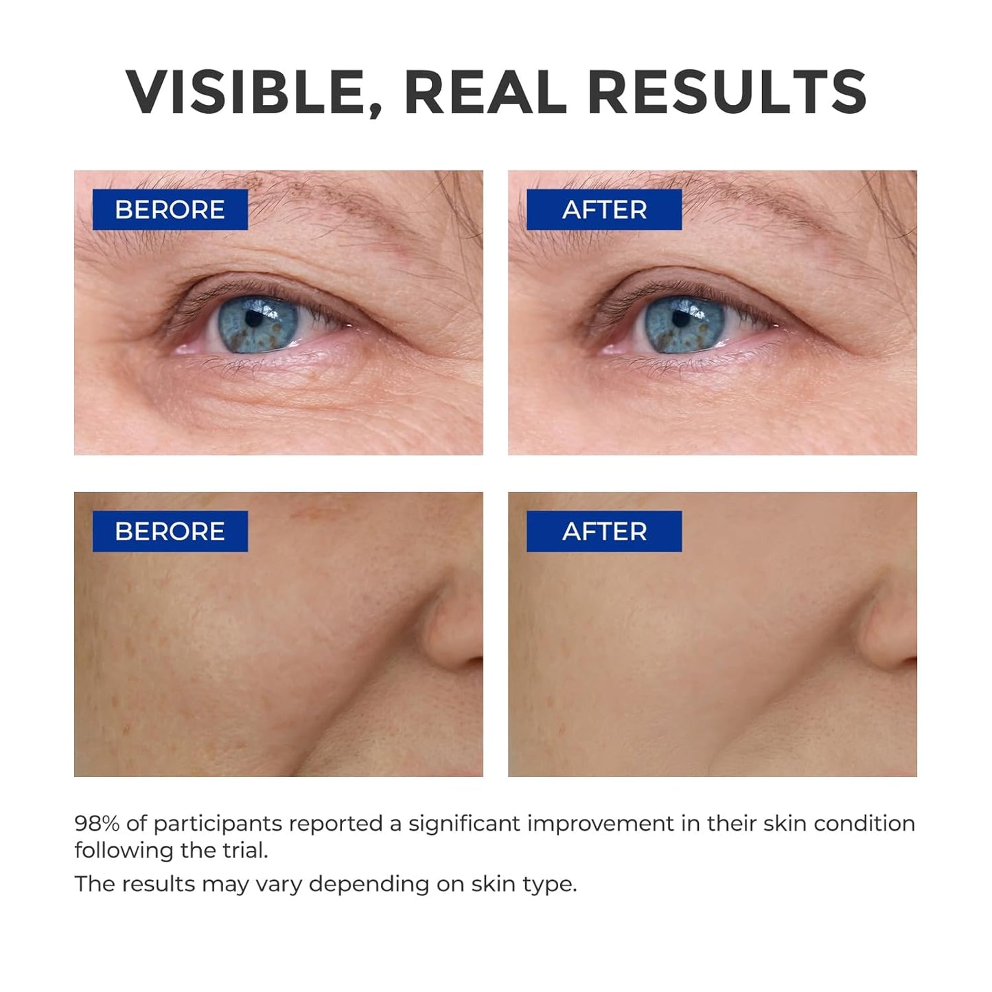 Retinol Serum for Face, Anti Aging Serum, Retinoid Collagen with Vitamin E Resurfacing Facial Rapid Fine Lines Repair, Brightening Pore Minimizer for Face Daily Skin Care Treatment 1oz