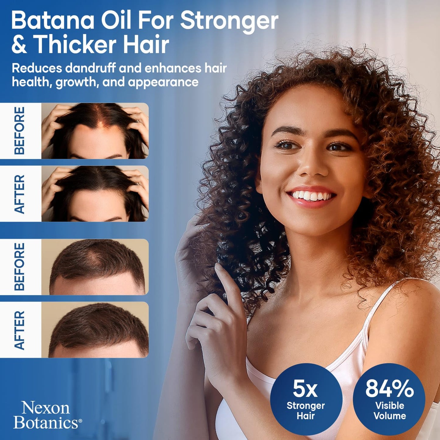 Raw Batana Oil for Hair Growth 4 fl oz - 100% Pure, Natural, Cold-Pressed Oil for Hair, Skin, Face & Lashes - Aceite de Batana