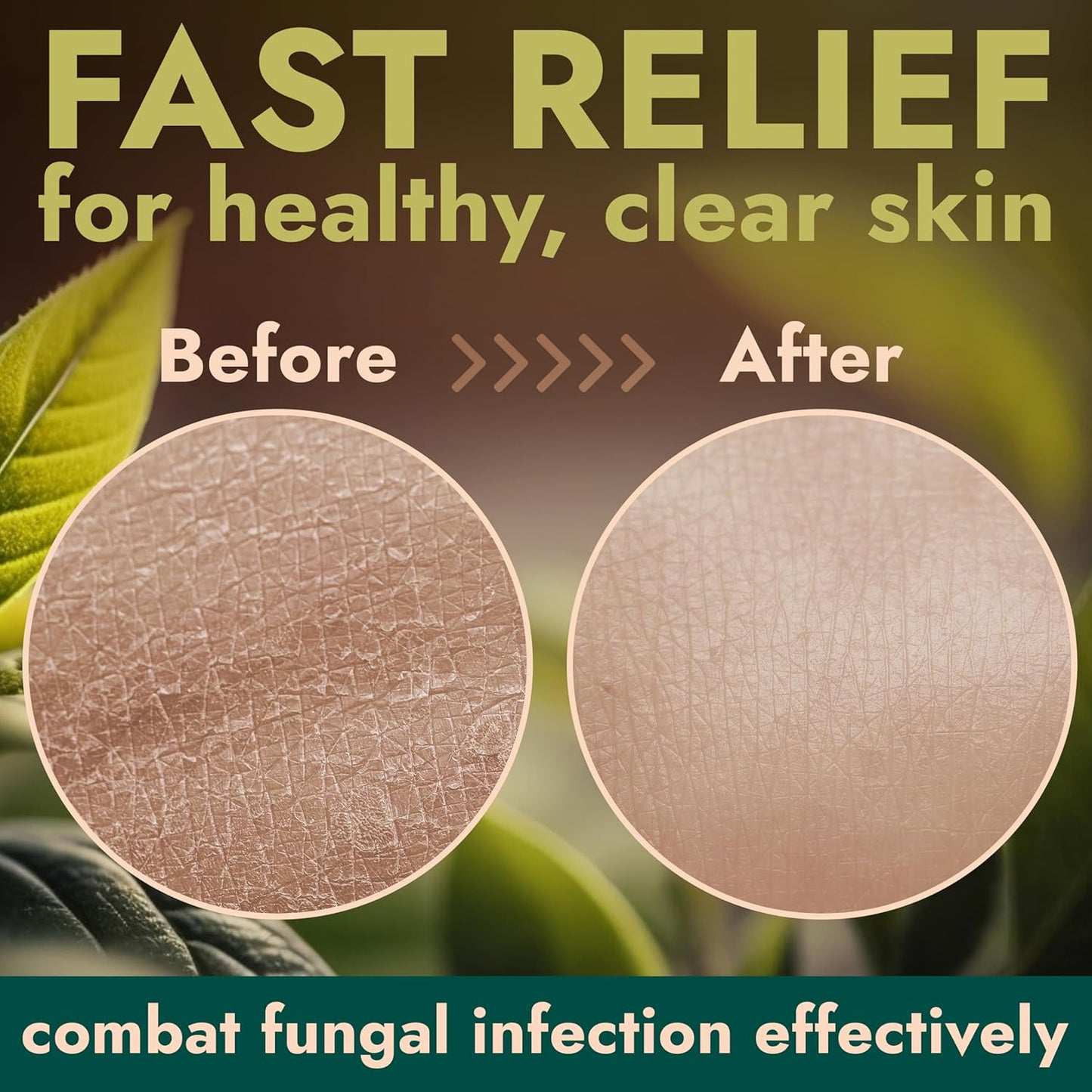 Antifungal Body Wash with Tea Tree Oil | Antibacterial Soap for Back Acne,Treats Ringworm, Eczema & Jock Itch | Antibacterial Body Soap For Men And Women | Includes Silicon Scrubber (16.9 oz)