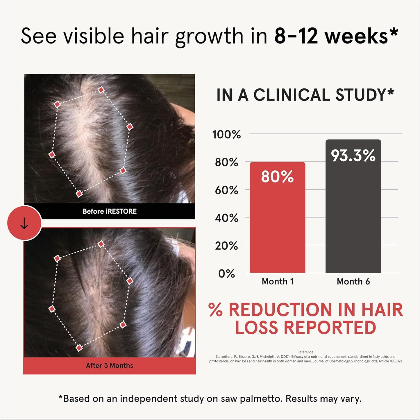 iRestore Hair Growth Supplement – Natural DHT Blockers & Multivitamin Blend – Vegan, Non-GMO, 90 Capsules – Supports Thicker, Stronger Hair for Men and Women – 3-Pack