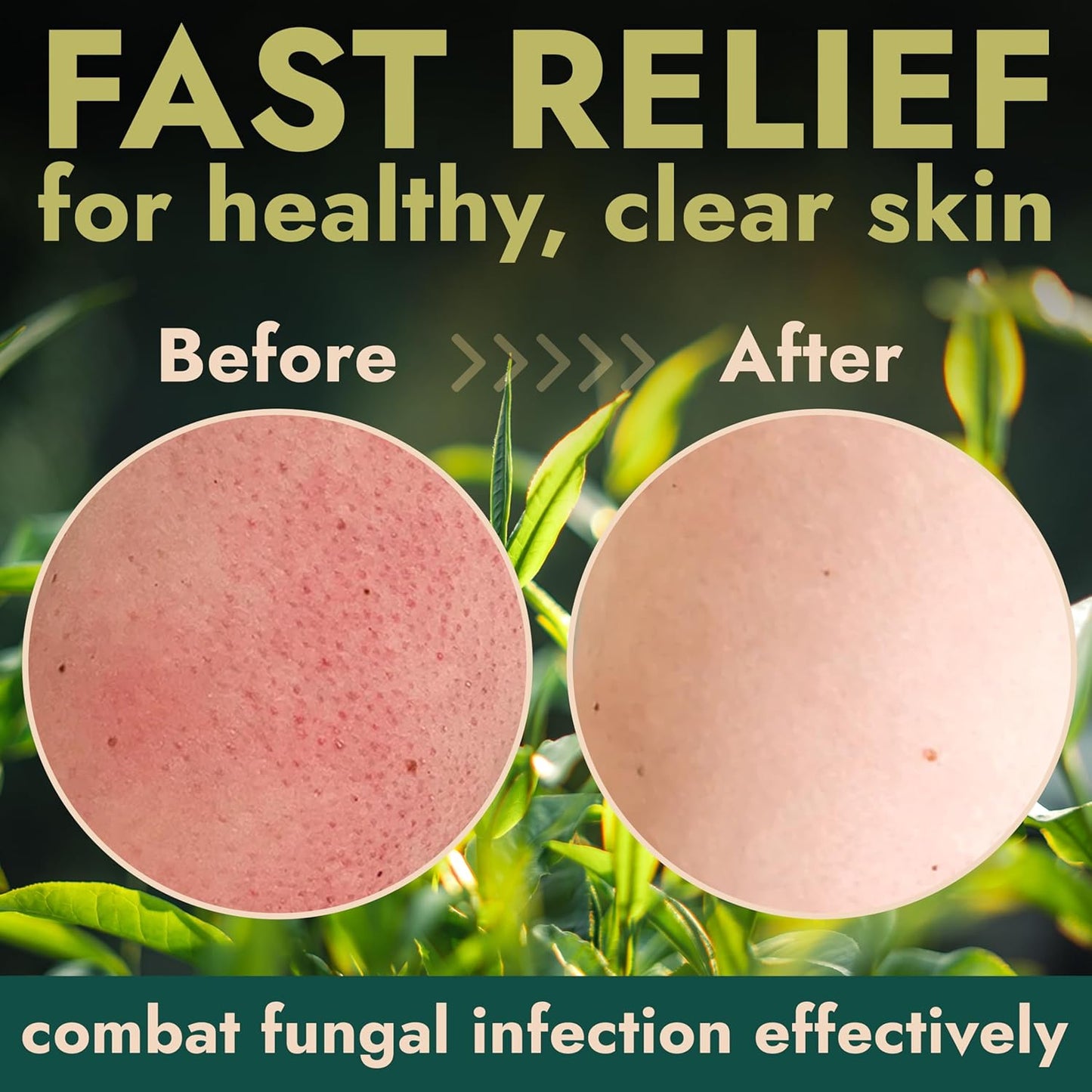 Terramed Just Think Comfort Antifungal Body Scrub with Tea Tree Oil – Exfoliating Body Wash for Women & Men – Soothes Itchy Skin, Rashes, Acne, Warts & Insects Bites – 12 Fl oz with Scrubber Brush